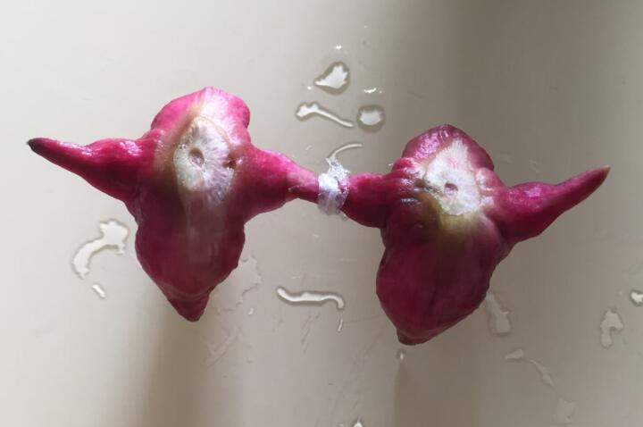 閉合粉刺能擠嗎?什么是閉合性粉刺?