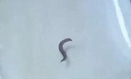 姐弟倆尿液中有黑色活蟲,懷疑和野外游泳有關(guān)